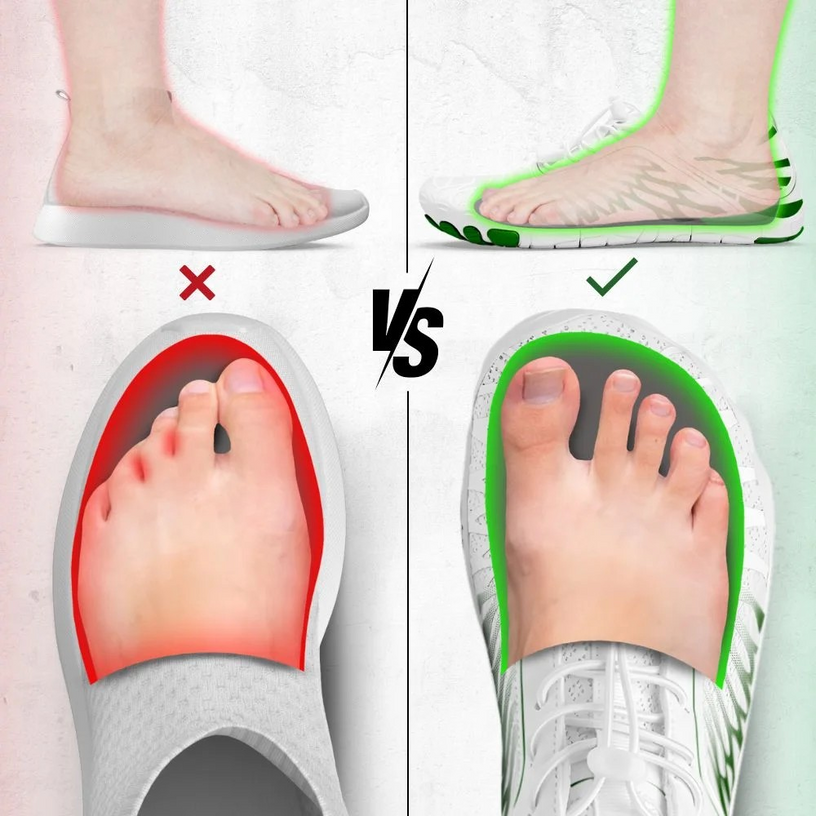 Wide_Toe-Box_For_Wide_Feet_Bunio.png__PID:a3be2083-3f57-4287-acdf-f01cb398f1a9